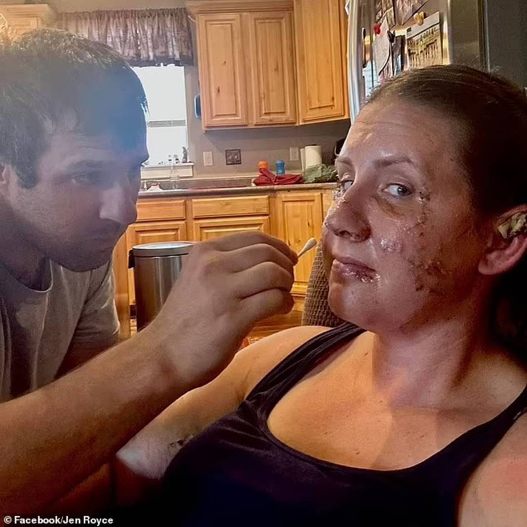 Nehre girdi, kanlar içinde çıktı! O canavar yüzünü paramparça etti... Arkasından usulca gelip... 8